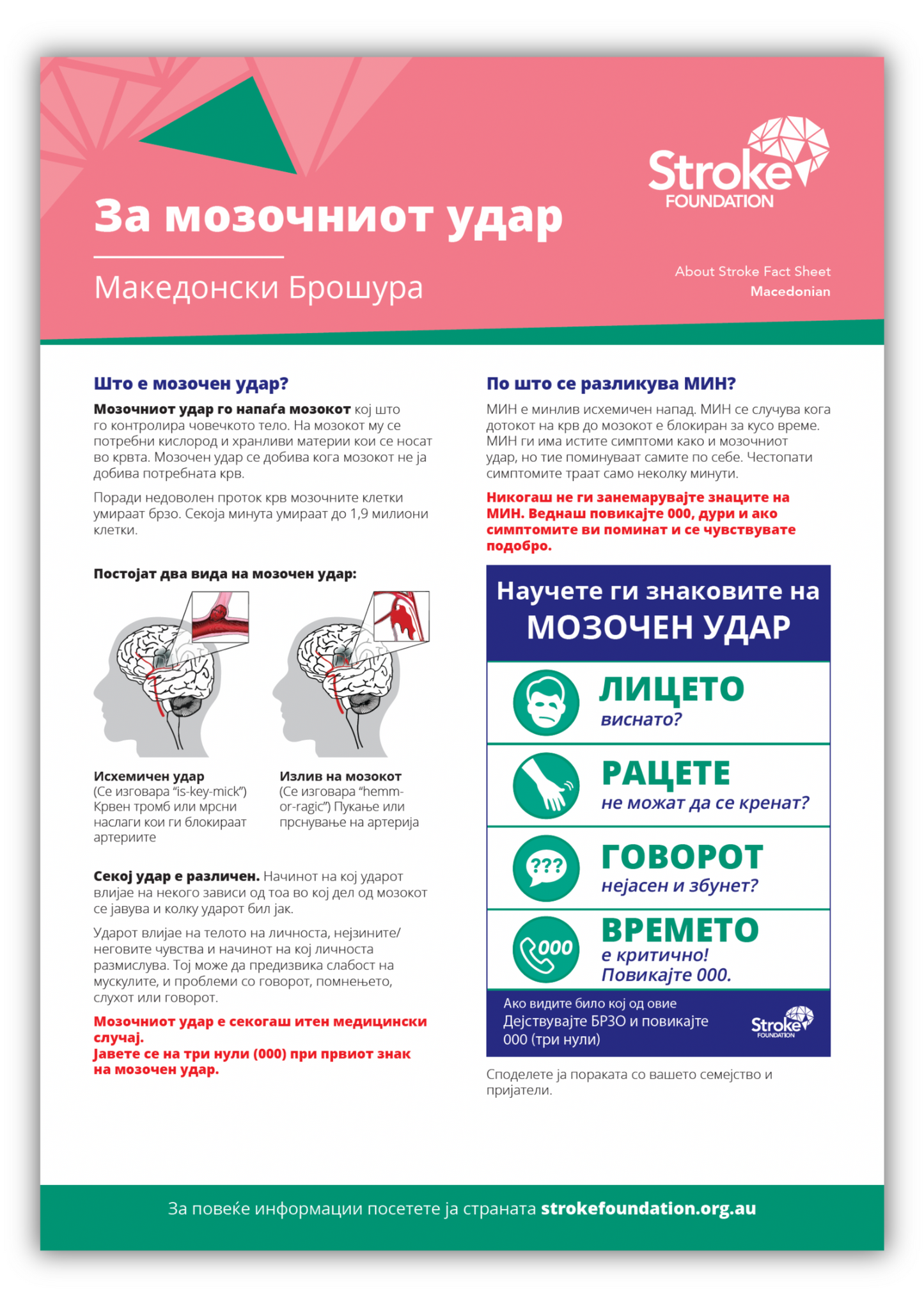 About Stroke fact sheet - македонски (Macedonian)