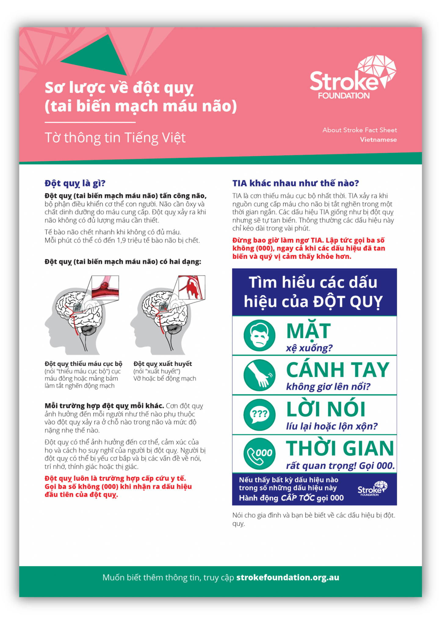 About Stroke fact sheet - Tiếng Việt (Vietnamese)
